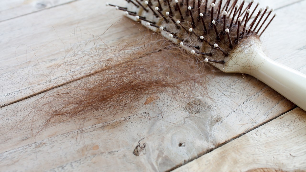 hair loss