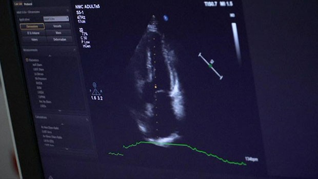Veja a reação de uma mãe ao ouvir o coração de seu filho morto em receptor de transplante