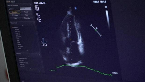 Veja a reação de uma mãe ao ouvir o coração de seu filho morto em receptor de transplante