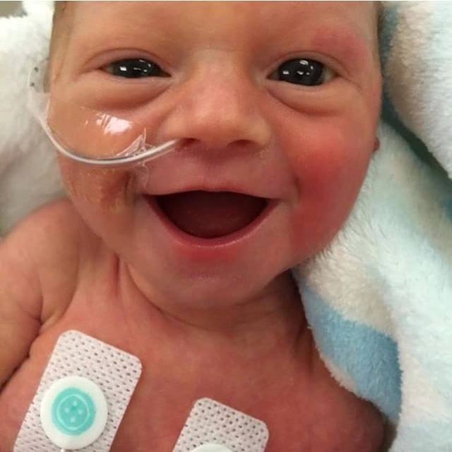 O sorrisão deste bebê prematuro de 5 dias de vida vai alegrar seu dia
