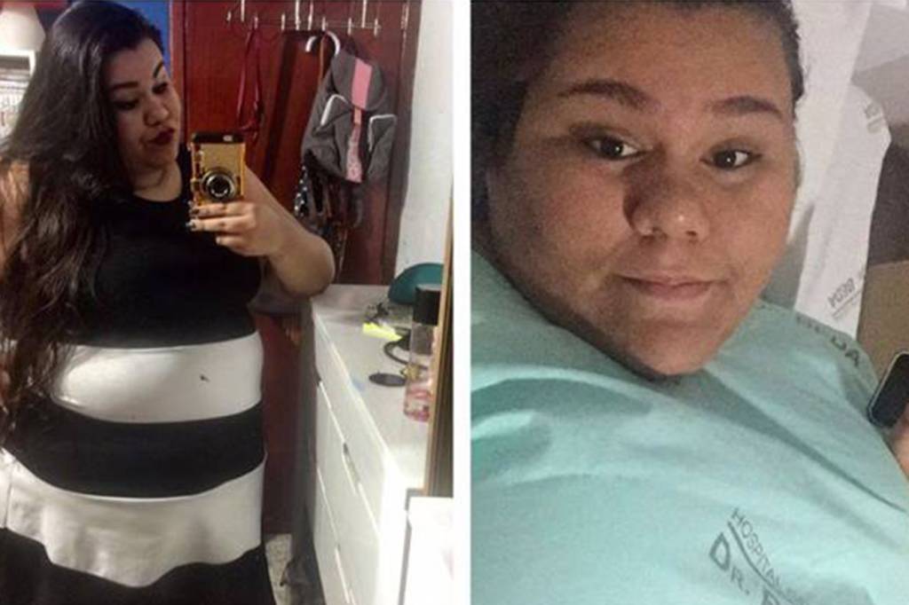 Jovem que sofria com preconceito morre após cirurgia bariátrica