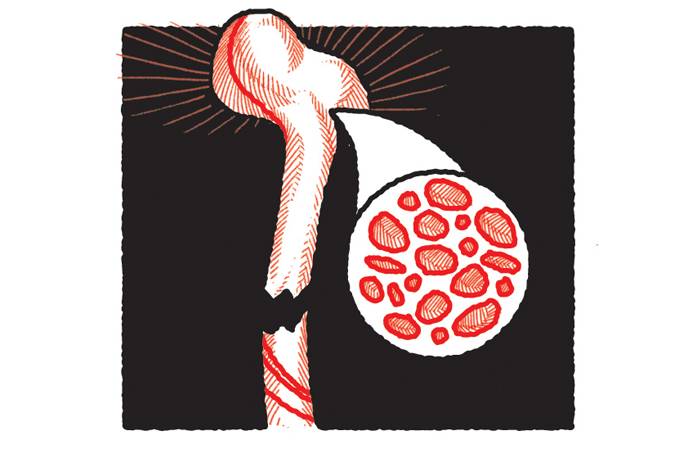 Dormir pouco pode aumentar risco de osteoporose e fraturas