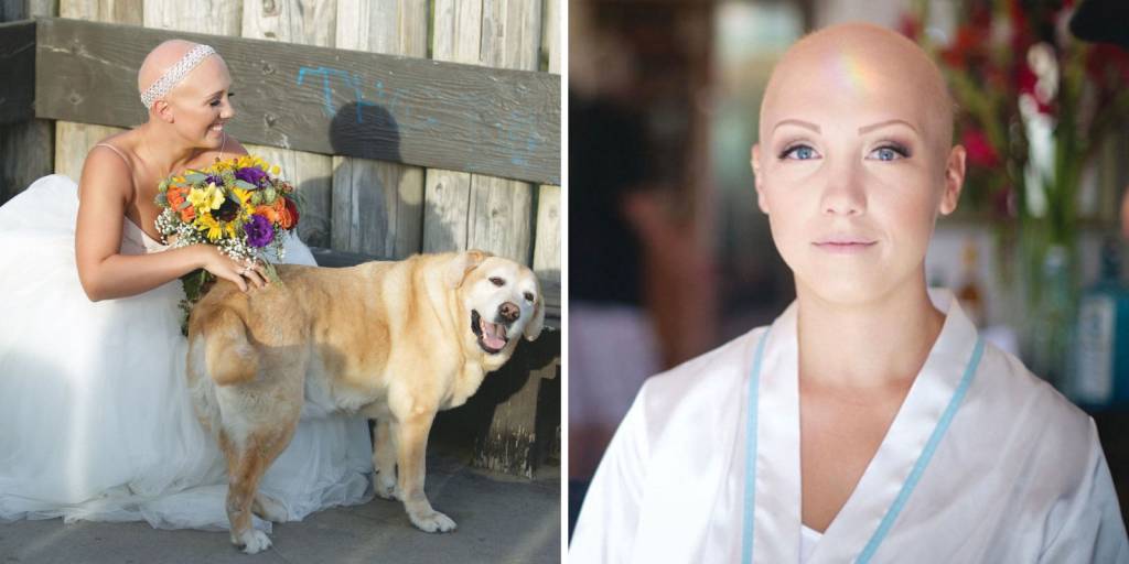 Noiva com alopecia emociona convidados com sua confiança