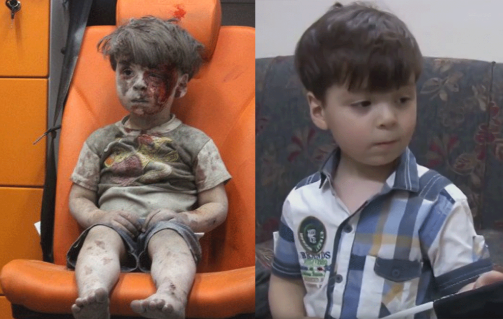 Menino resgatado na Síria, que comoveu o mundo, aparece recuperado