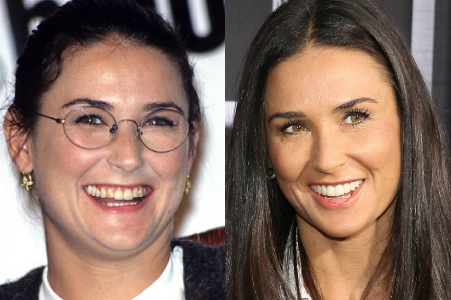 demi-moore-antes-depois