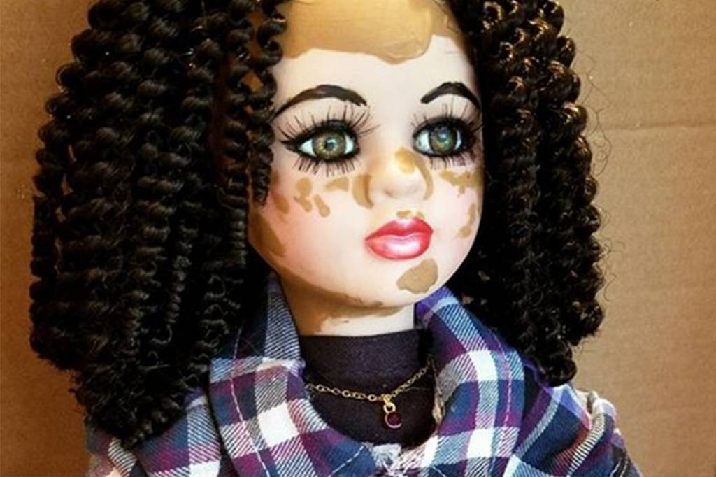 Artista cria bonecas com vitiligo para ajudar a autoestima de meninas