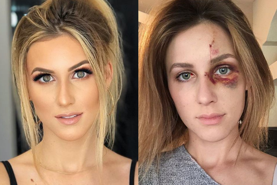 Mineira é espancada pelo namorado nos EUA e grava áudios da discussão