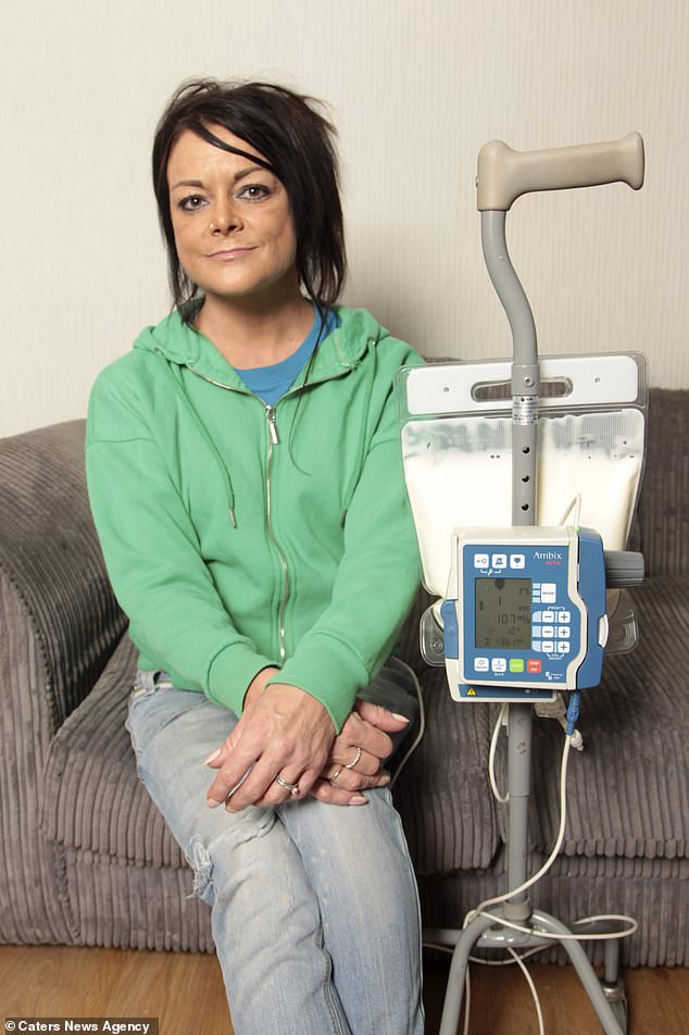 mulher est&ocirc;mago ces&aacute;rea