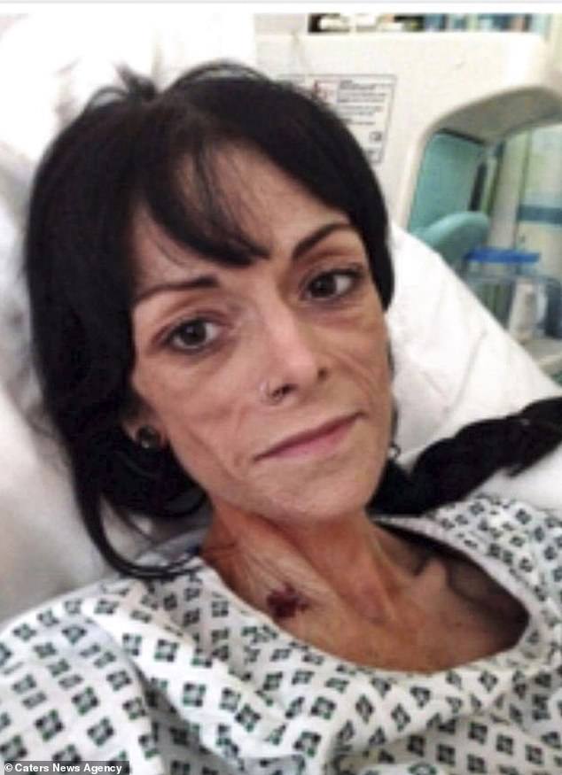 mulher est&ocirc;mago cesariana