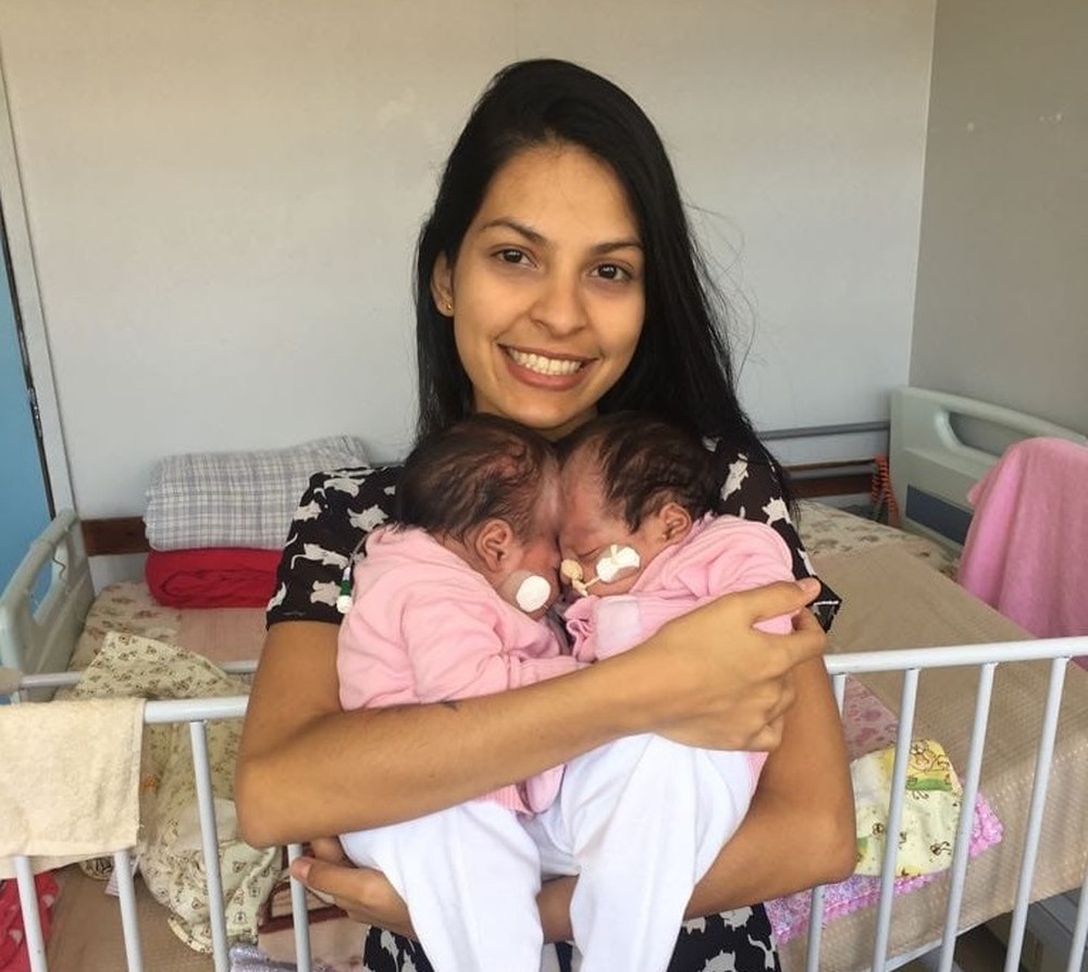 gemeas-siamesas-lis-mel