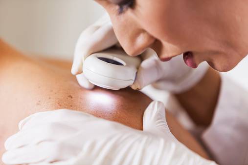 Dezembro laranja: a importância de prevenir o câncer de pele