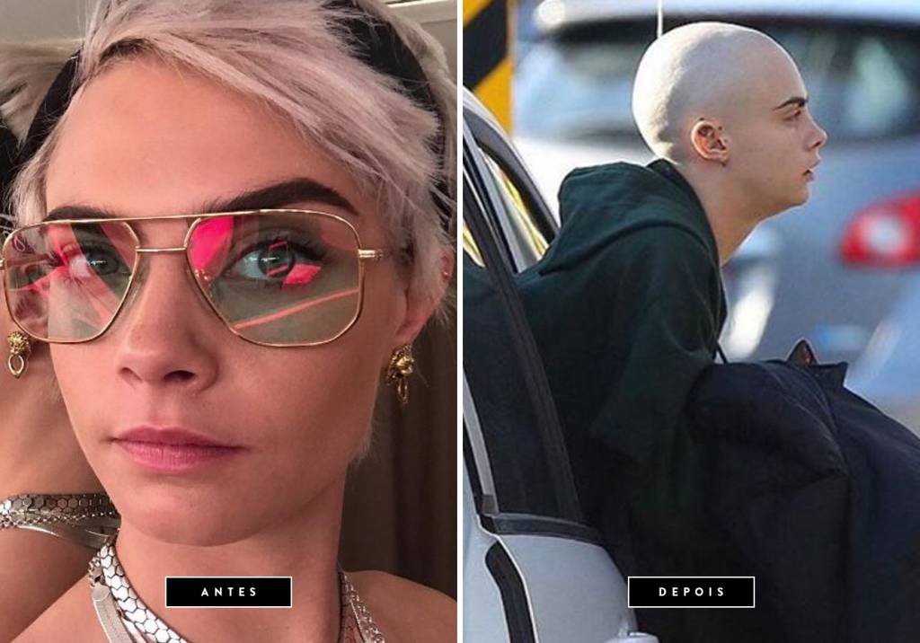 <strong>Abril de 2017 //&nbsp;Cara Delevingne</strong> -&nbsp;Pouco tempo depois de encarar o visual platinado, a modelo e atriz radicalizou mais uma vez. A brit&acirc;nica raspou completamente os cabelos para o filme <em>Life In a Year</em>, com estreia prevista para 2018. Na produ&ccedil;&atilde;o, Cara dar&aacute; vida a uma adolescente em estado terminal.