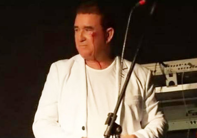 Amado Batista comenta pedrada durante show: “As pessoas não se respeitam mais”