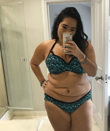Blogueira inclui cicatrizes nas discussões sobre body positive
