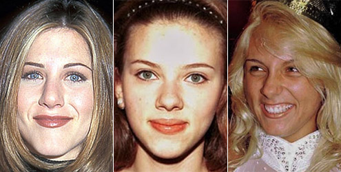 Famosas que fizeram plástica no nariz: veja o antes e o depois