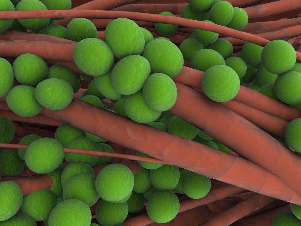 Entenda mais sobre a superbactéria que causou a morte do neto de Lula