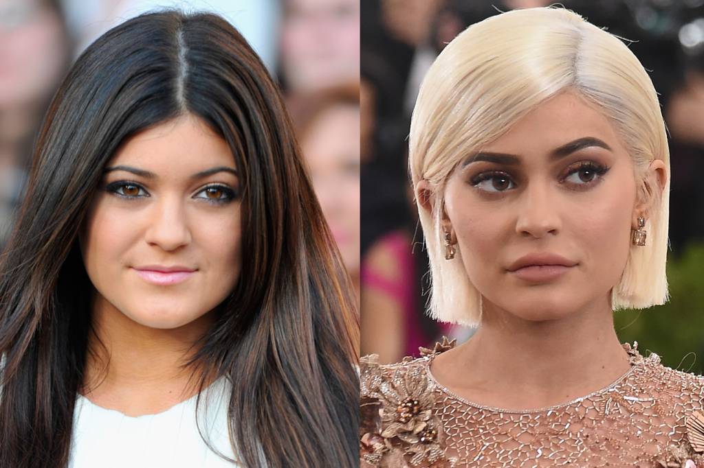 kylie-jenner-antes-e-depois
