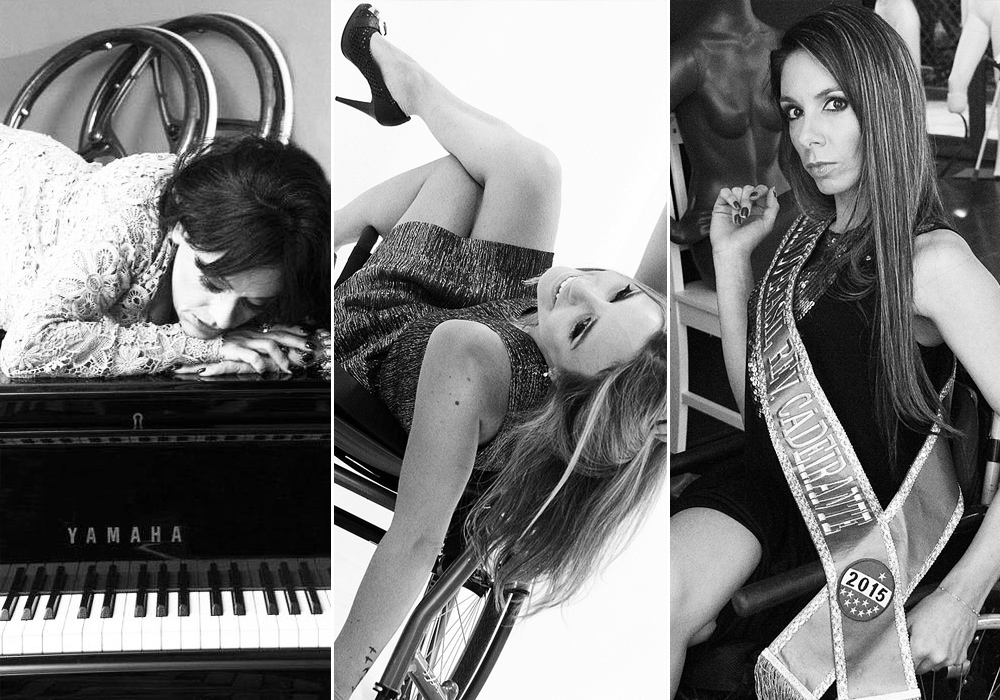 6 modelos com deficiência provam que beleza é para todos