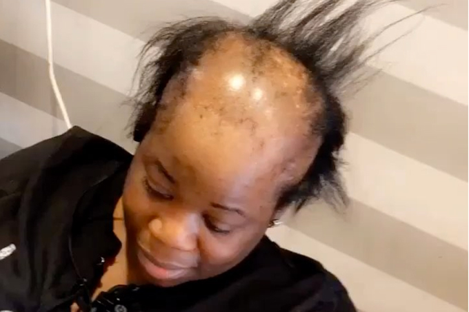 Mulher que perdeu o cabelo passa por transformação impressionante