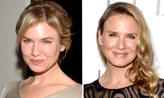 Renée Zellweger surge irreconhecível no red carpet