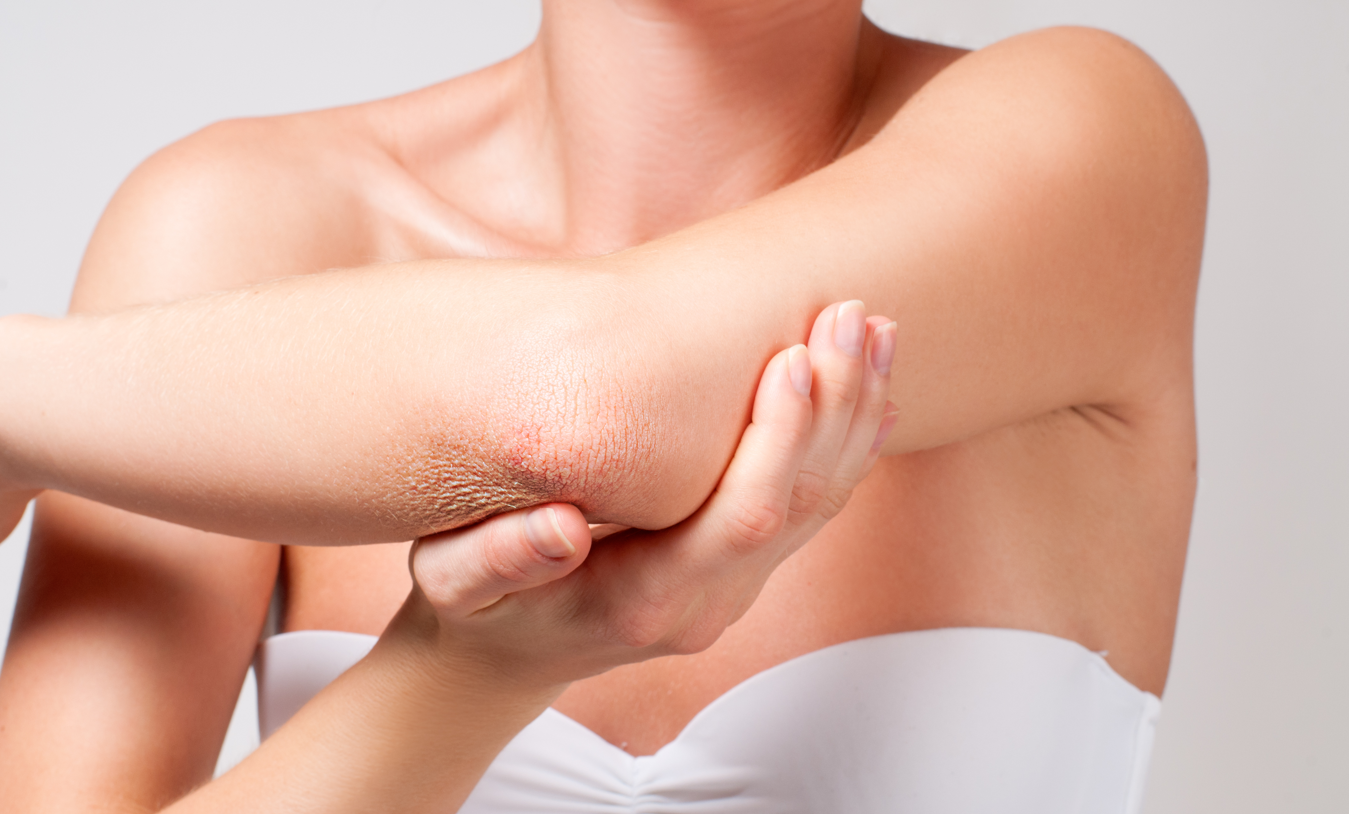 Beauty and Body care. Female elbow.