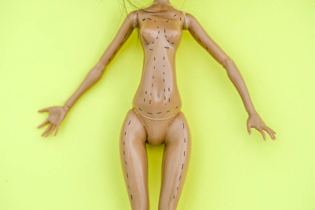 Lipo LAD e o polêmico debate sobre a romantização das cirurgias plásticas