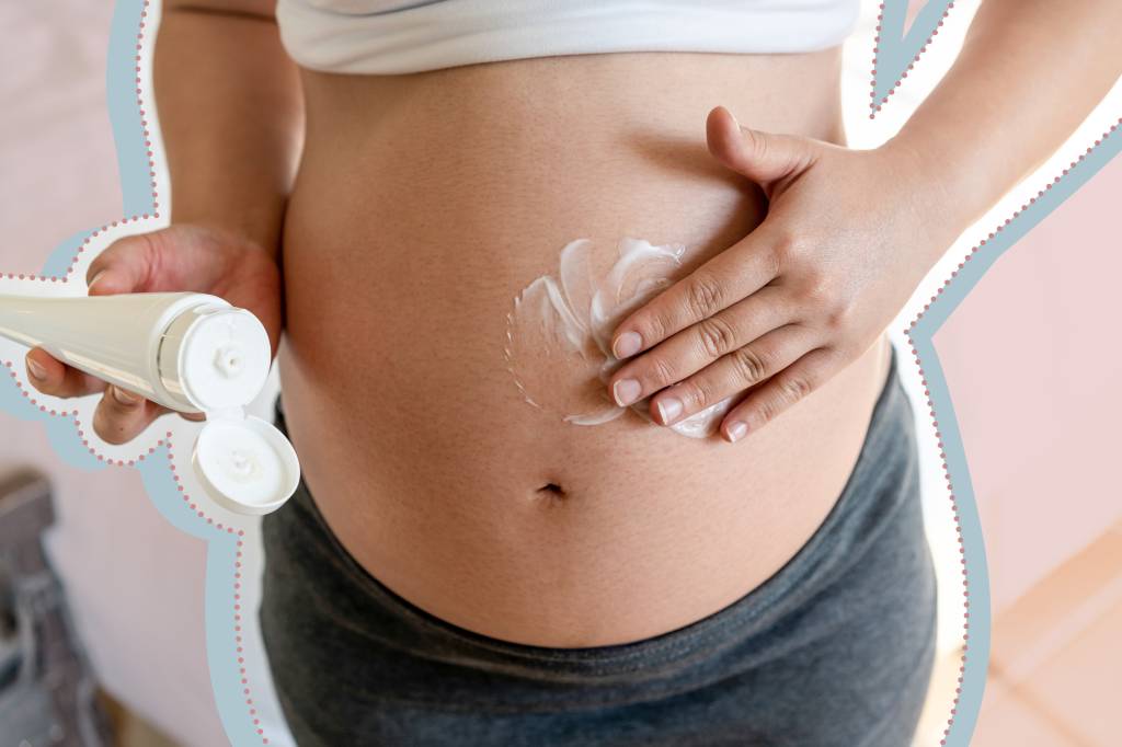 Como prevenir estrias na gravidez. Veja dicas e sugestões de produtos
