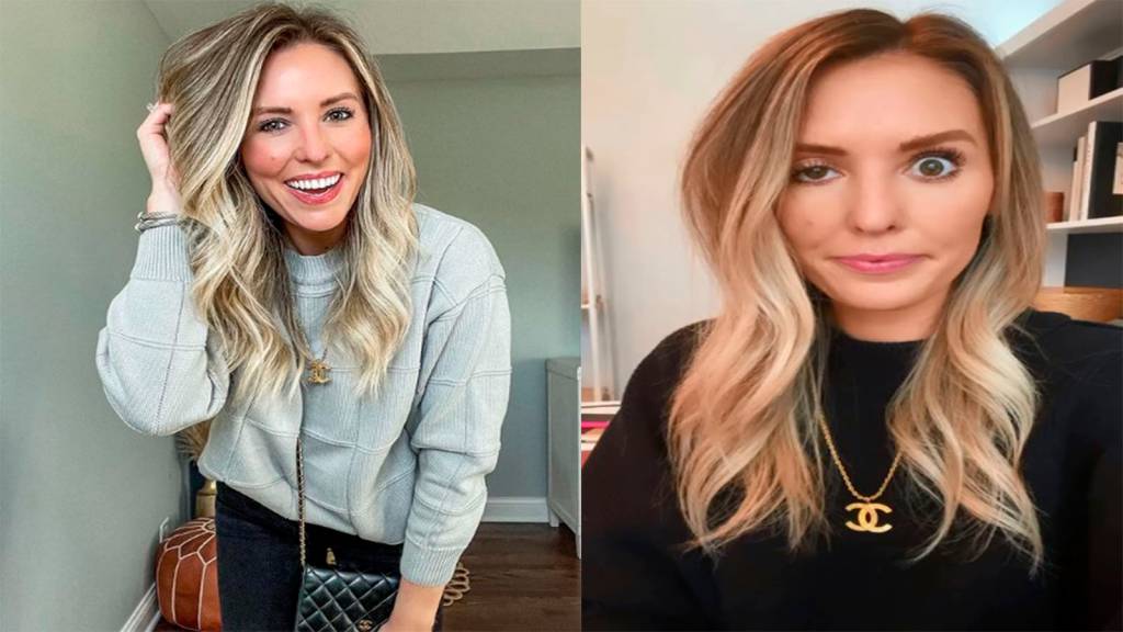 Influenciadora fica com olho arregalado por causa de botox; veja cuidados