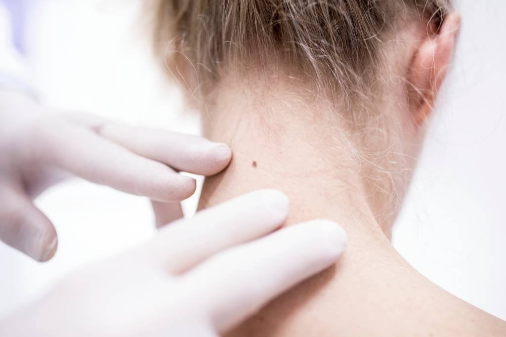 Dicas para você proteger sua pele e curtir o verão com segurança