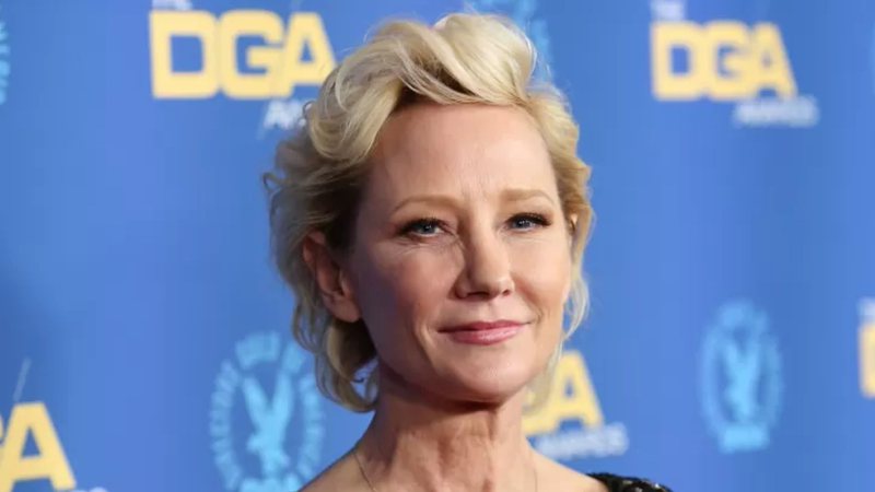 Atriz Anne Heche morre aos 53 anos