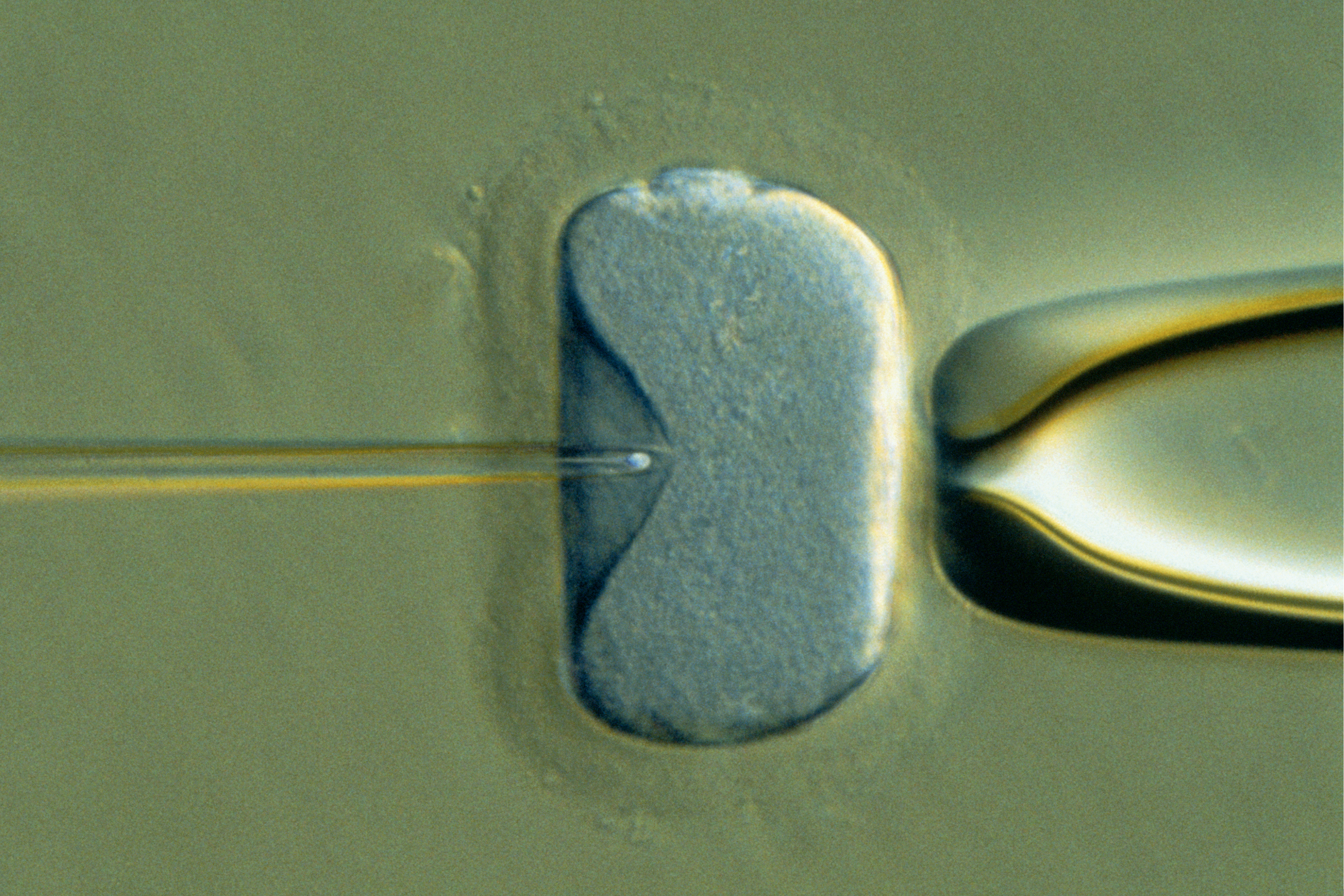 Quem faz o procedimento aos 39 anos tem uma taxa de &ecirc;xito de 15%.