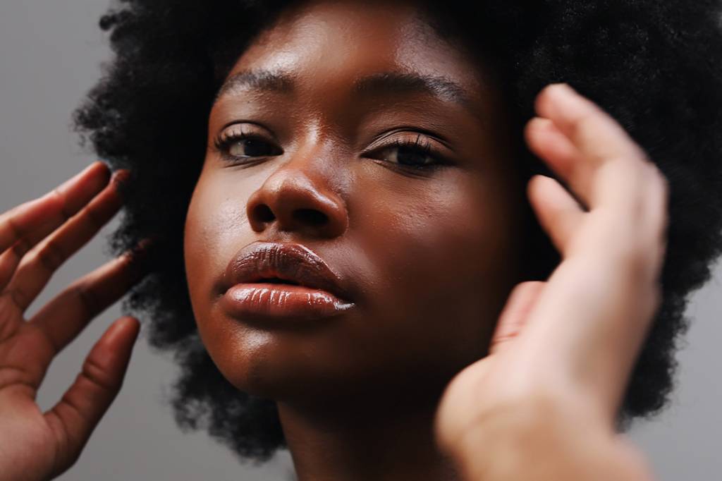 Melasma na pele negra: cuidados que você deve ter