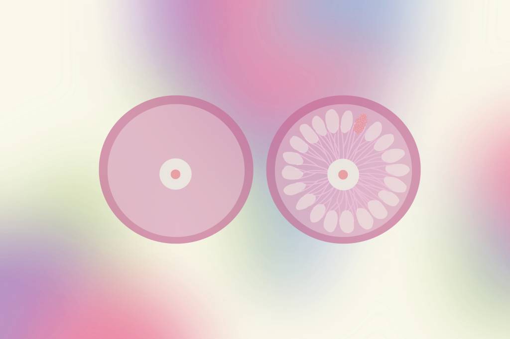 O papel da espiritualidade no tratamento do câncer de mama