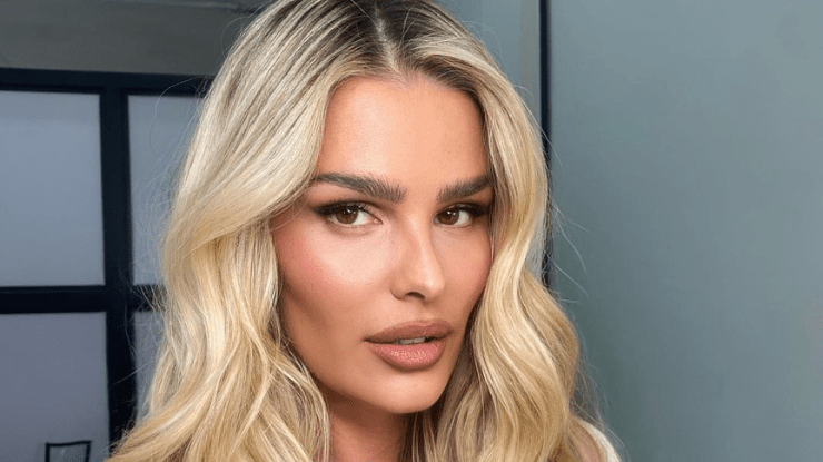 Yasmin Brunet desabafa sobre lipedema e compulsão alimentar