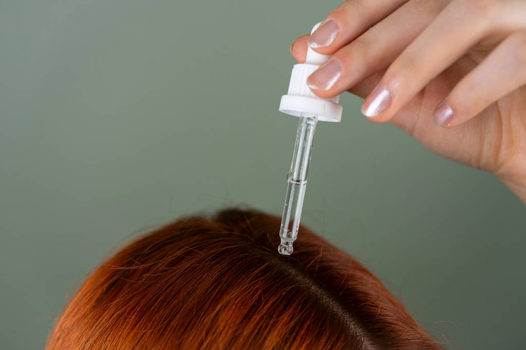Minoxidil ajuda a crescer o cabelo? Veja antes e depois!
