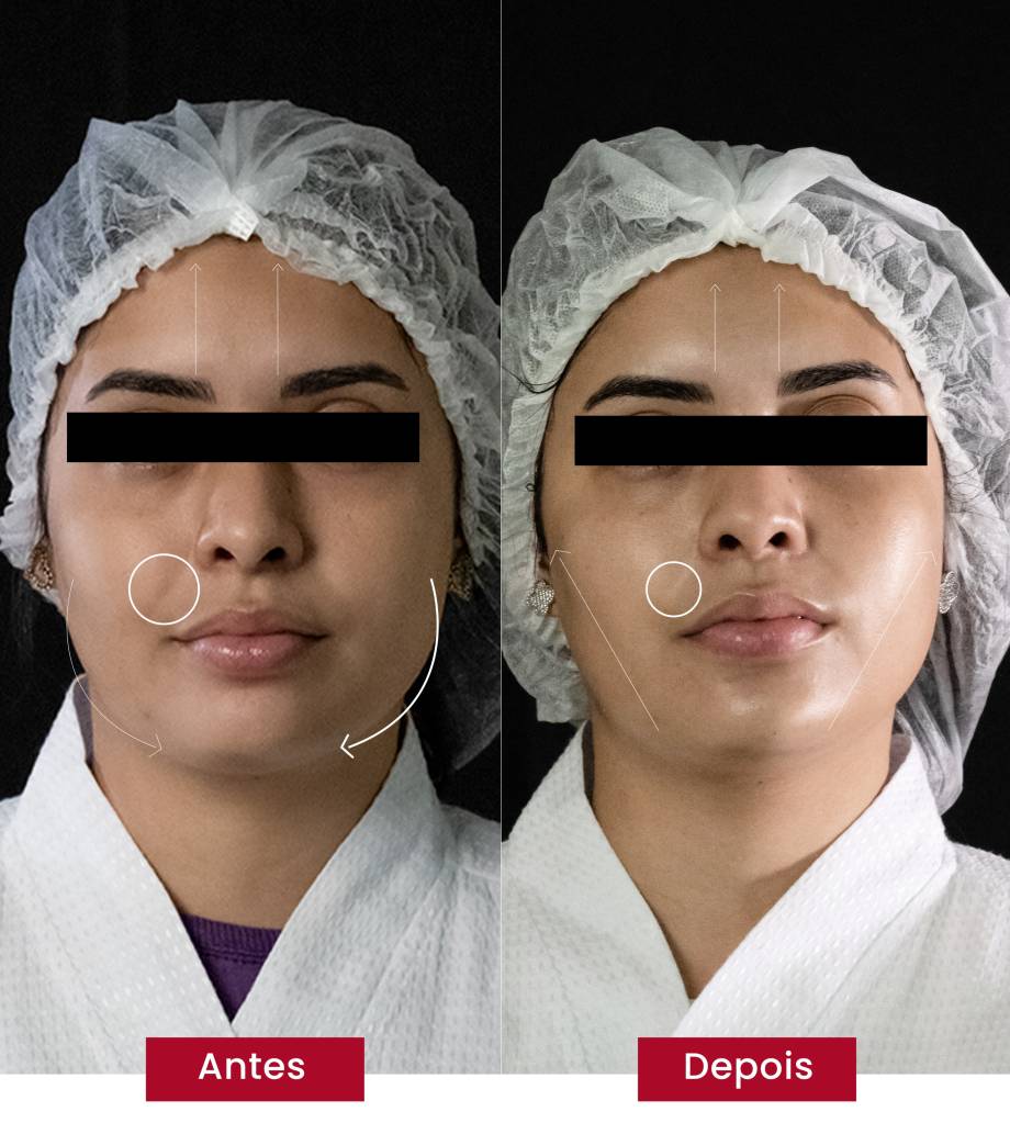 glass-skin-coreana (1) Em três sessões, é possível ver diferenças no rosto de quem faz a glass skin coreana