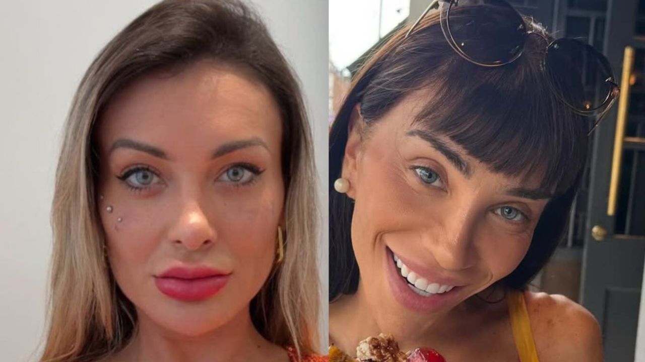 Duas imagens mostram como ficaram os olhos de Andressa Urach e Maya Massafera após cirurgia.