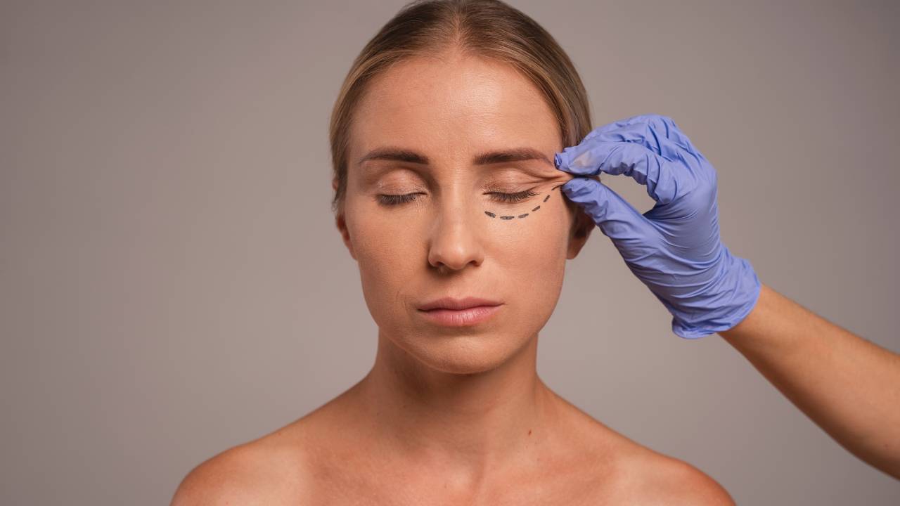 Imagem de mulher loira de olhos fechados, com marcas de caneta para procedimento estético e uma mão com luva de médico segurando parte de sua pele.