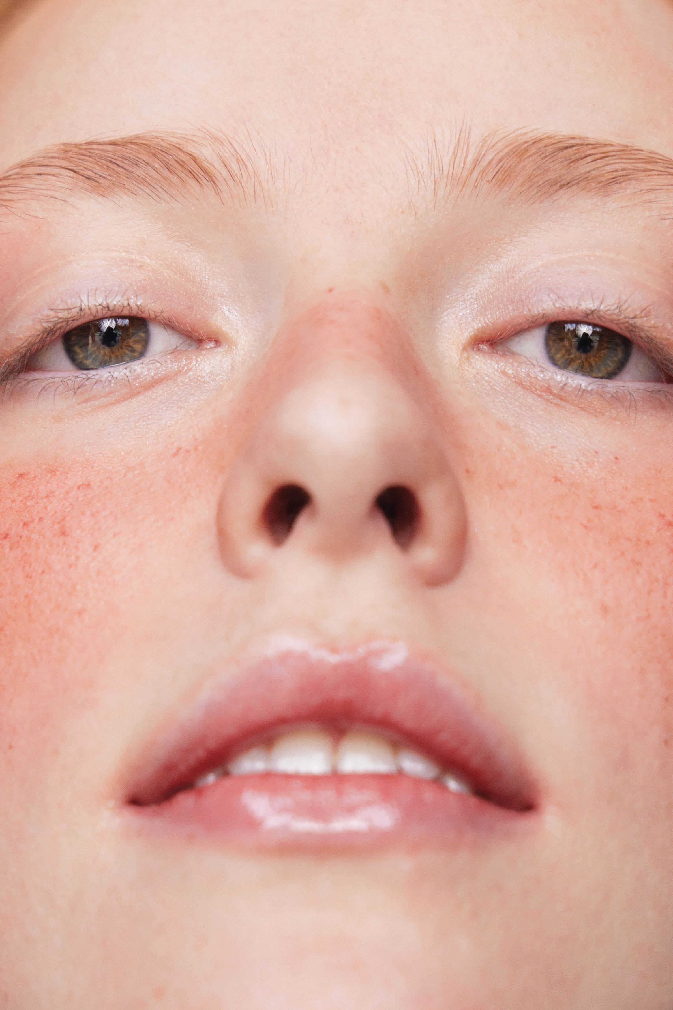 Close no rosto de mulher branca com a pele rosada