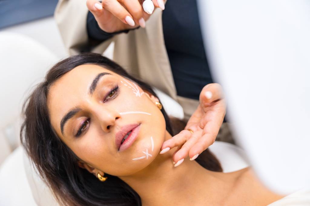 Fios de sustentação: o lifting sem cirurgia da dermatologia