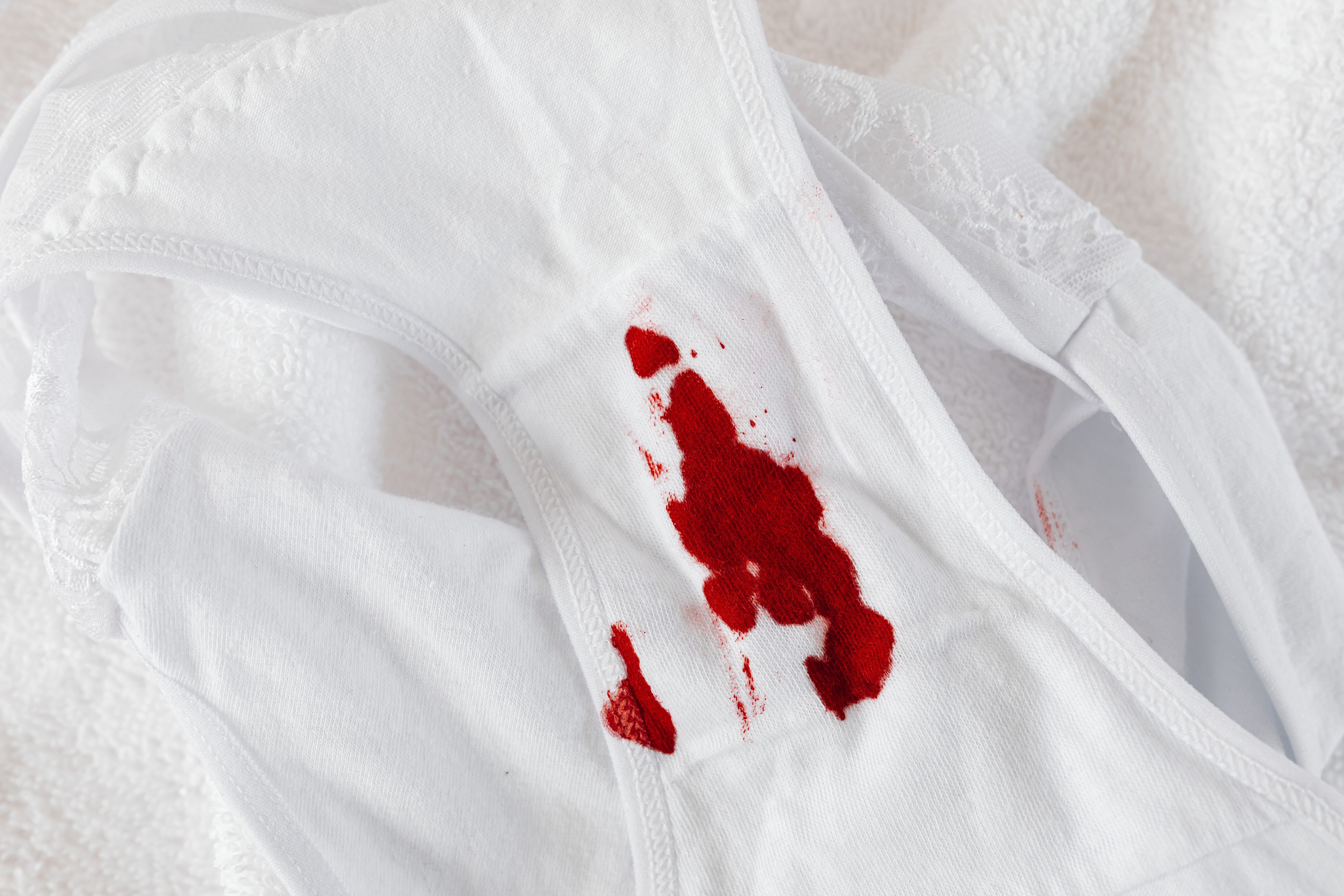 Calcinha branca de algod&atilde;o com manchas de sangue menstrual no centro, sobre uma toalha branca