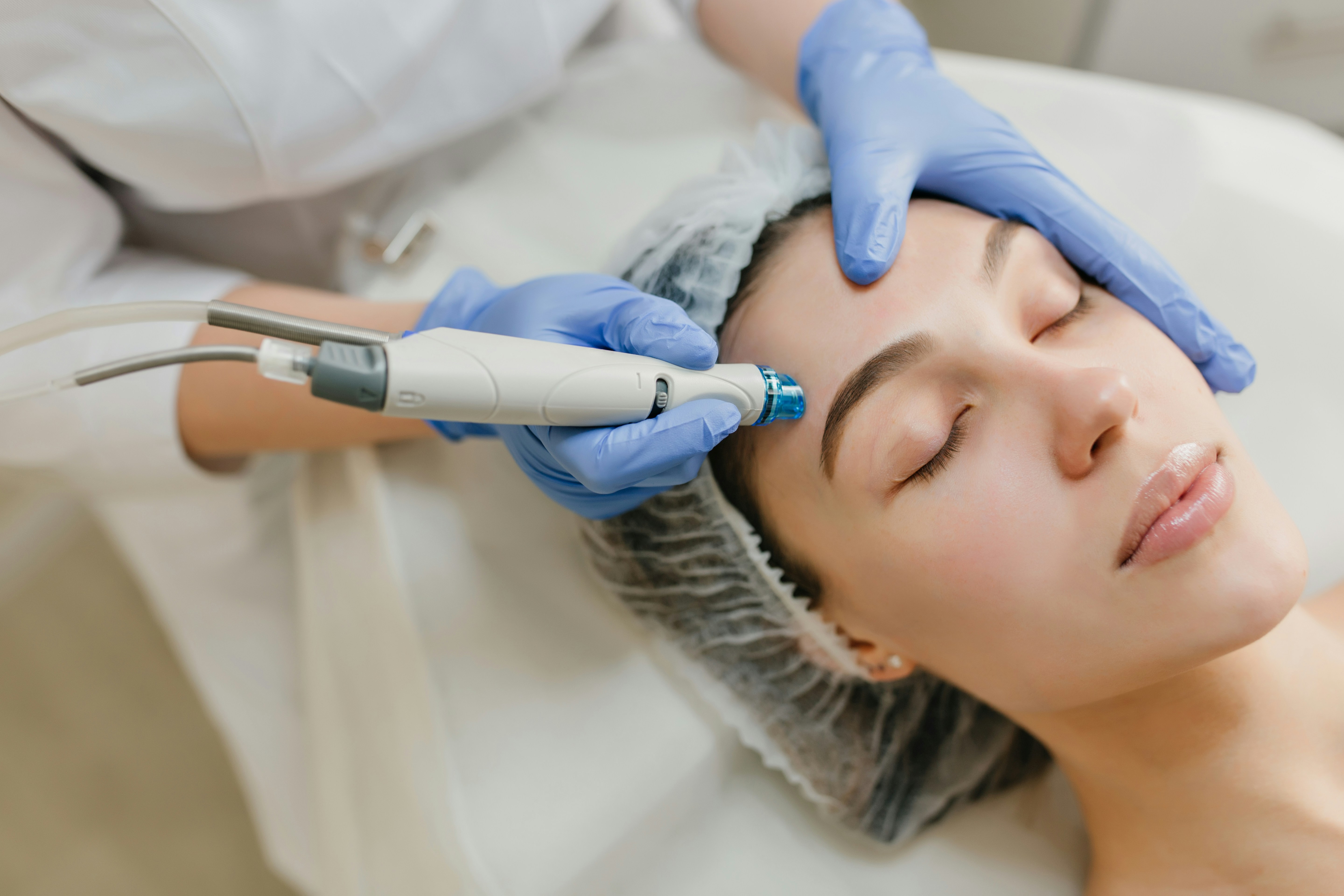 Uma mulher deitada com touca descart&aacute;vel recebe tratamento facial com aparelho est&eacute;tico, aplicado por m&atilde;os com luvas azuis na testa