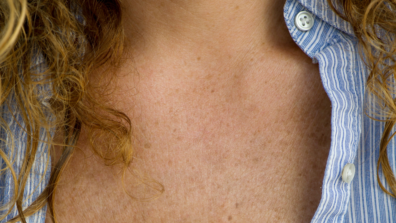 Close-up do colo de uma pessoa com pele clara e sardas, usando uma camisa azul listrada com botões brancos, e cabelos loiros ondulados soltos